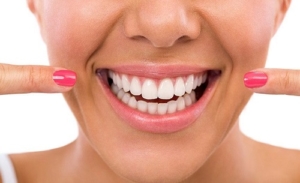 Smiling woman showing her perfect white teeth