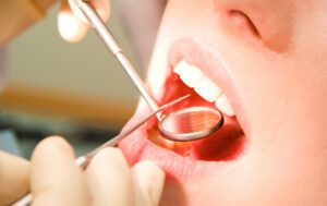 Teeth Whitening Dentist What to look for