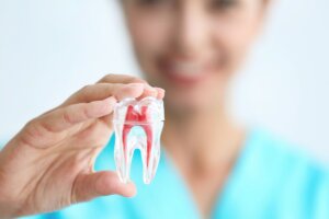 The Pros & Cons Of Root Canal Therapy Explained - Monroe Family Dentistry