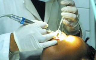 Receding Gum & How To Prevent It - Monroe Family Dentistry