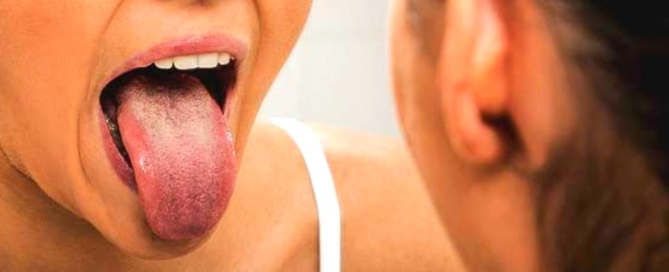 Oral Lichen Planus Explained - Monroe Family Dentistry