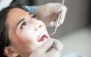 Understanding Root Canal Infections - Monroe Family Dentistry